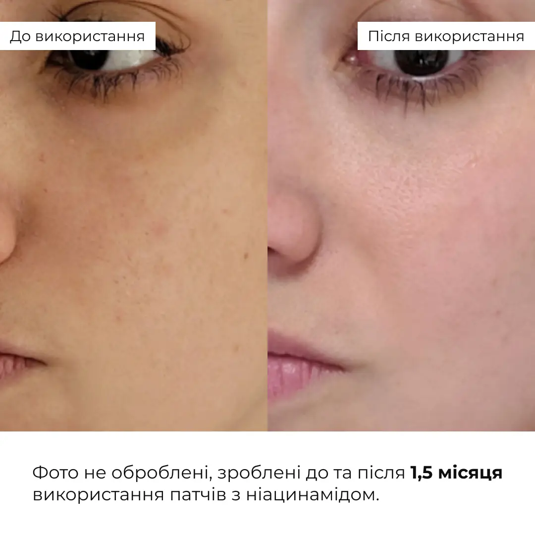 Мультифункциональные патчи с ниацинамидом Hillary Niacinamide Multi Eye Patches, HI-08-867 10