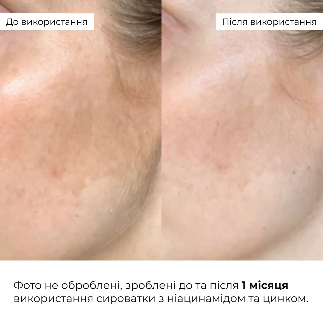 Мультисироватка з ніацинамідом та цинком Hillary Multi Niacinamid serum, 30 мл, K-08-245 5